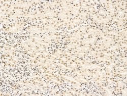 Invitrogen KLF2 Polyclonal Antibody 100 &mu;L; Unconjugated:Antibodies,
