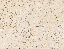 Invitrogen KLF2 Polyclonal Antibody 100 &mu;L; Unconjugated:Antibodies,