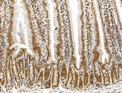Invitrogen KLF2 Polyclonal Antibody 100 &mu;L; Unconjugated:Antibodies,