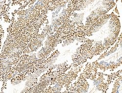 Invitrogen KLF2 Polyclonal Antibody 100 &mu;L; Unconjugated:Antibodies,