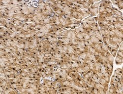 Invitrogen KLF2 Polyclonal Antibody 100 &mu;L; Unconjugated:Antibodies,