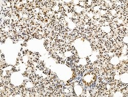 Invitrogen KLF2 Polyclonal Antibody 100 &mu;L; Unconjugated:Antibodies,