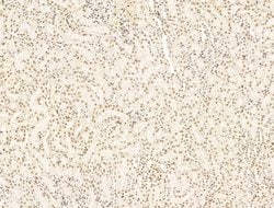 Invitrogen KLF2 Polyclonal Antibody 100 &mu;L; Unconjugated:Antibodies,