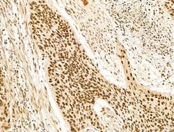 Invitrogen KLF2 Polyclonal Antibody 100 &mu;L; Unconjugated:Antibodies,