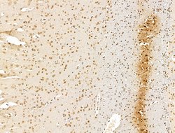 Invitrogen KLF2 Polyclonal Antibody 100 &mu;L; Unconjugated:Antibodies,