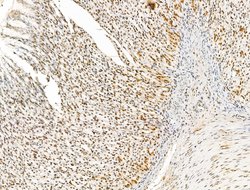Invitrogen KLF2 Polyclonal Antibody 100 &mu;L; Unconjugated:Antibodies,