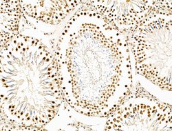 Invitrogen KLF2 Polyclonal Antibody 100 &mu;L; Unconjugated:Antibodies,
