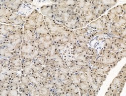 Invitrogen KLF2 Polyclonal Antibody 100 &mu;L; Unconjugated:Antibodies,