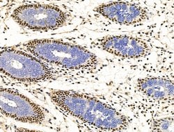Invitrogen KLF2 Polyclonal Antibody 100 &mu;L; Unconjugated:Antibodies,