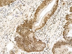 Invitrogen KLF2 Polyclonal Antibody 100 &mu;L; Unconjugated:Antibodies,