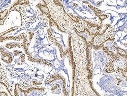 Invitrogen KLF2 Polyclonal Antibody 100 &mu;L; Unconjugated:Antibodies,