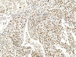Invitrogen KLF2 Polyclonal Antibody 100 &mu;L; Unconjugated:Antibodies,