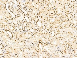Invitrogen KLF2 Polyclonal Antibody 100 &mu;L; Unconjugated:Antibodies,