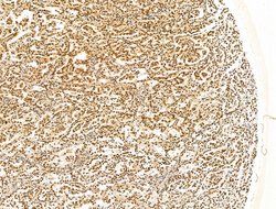 Invitrogen KLF2 Polyclonal Antibody 100 &mu;L; Unconjugated:Antibodies,