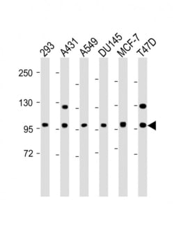 Invitrogen E-cadherin Polyclonal Antibody 400 &mu;L; Unconjugated:Antibodies,