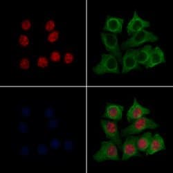 Invitrogen KLF5 Polyclonal Antibody 100 &mu;L; Unconjugated:Antibodies,