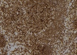 Invitrogen Kallikrein 1 Polyclonal Antibody 100 μL; Unconjugated:Antibodies,
