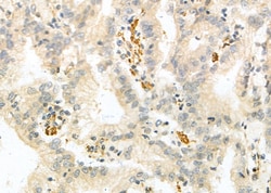 Invitrogen NKG2A Polyclonal Antibody 100 &mu;L; Unconjugated:Antibodies,