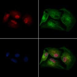 Invitrogen SUV420H2 Polyclonal Antibody 100 &mu;L; Unconjugated:Antibodies,