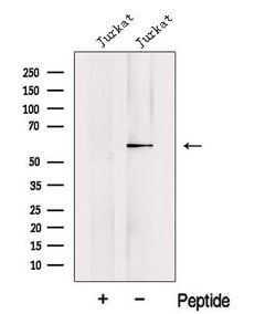 Invitrogen KPNA5 Polyclonal Antibody 100 &mu;L; Unconjugated:Antibodies,