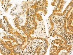 Invitrogen KV1.3 (KCNA3) Polyclonal Antibody 100 &mu;L | Buy Online | Invitrogen&trade; | Fisher Scientific