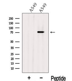 Invitrogen KV1.3 (KCNA3) Polyclonal Antibody 100 &mu;L | Buy Online | Invitrogen&trade; | Fisher Scientific