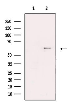Invitrogen KV1.6 (KCNA6) Polyclonal Antibody 100 &mu;L; Unconjugated:Antibodies,