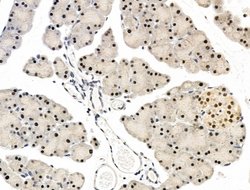 Invitrogen L3MBTL1 Polyclonal Antibody 100 &mu;L; Unconjugated:Antibodies,