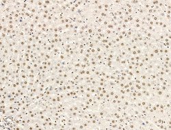 Invitrogen L3MBTL1 Polyclonal Antibody 100 &mu;L; Unconjugated:Antibodies,