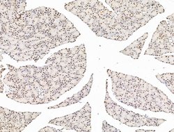 Invitrogen L3MBTL1 Polyclonal Antibody 100 &mu;L; Unconjugated:Antibodies,