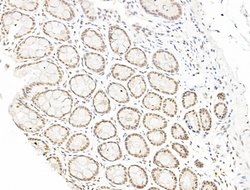 Invitrogen L3MBTL1 Polyclonal Antibody 100 &mu;L; Unconjugated:Antibodies,