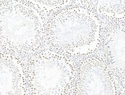 Invitrogen L3MBTL1 Polyclonal Antibody 100 &mu;L; Unconjugated:Antibodies,