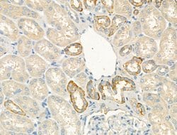 Invitrogen Laminin Polyclonal Antibody 100 &mu;L; Unconjugated:Antibodies,