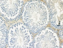 Invitrogen Laminin Polyclonal Antibody 100 &mu;L; Unconjugated:Antibodies,