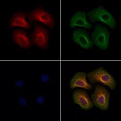 Invitrogen LAMTOR1 Polyclonal Antibody 100 &mu;L; Unconjugated:Antibodies,
