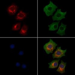 LARS2 Polyclonal Antibody:Antibodies, Polyclonal