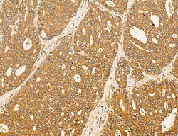 LARS2 Polyclonal Antibody:Antibodies, Polyclonal