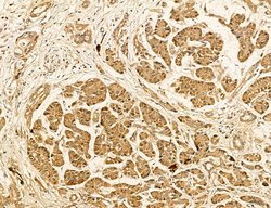 LARS2 Polyclonal Antibody:Antibodies, Polyclonal