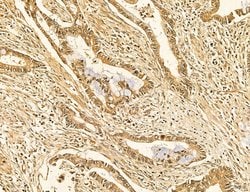 LARS2 Polyclonal Antibody:Antibodies, Polyclonal