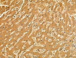 LARS2 Polyclonal Antibody:Antibodies, Polyclonal