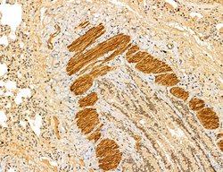 LARS2 Polyclonal Antibody:Antibodies, Polyclonal
