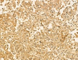 LARS2 Polyclonal Antibody:Antibodies, Polyclonal