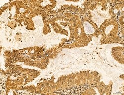 LARS2 Polyclonal Antibody:Antibodies, Polyclonal