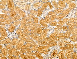 LARS2 Polyclonal Antibody:Antibodies, Polyclonal