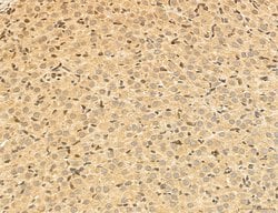 LARS2 Polyclonal Antibody:Antibodies, Polyclonal