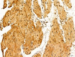 LARS2 Polyclonal Antibody:Antibodies, Polyclonal