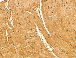 LARS2 Polyclonal Antibody:Antibodies, Polyclonal