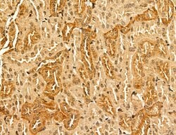 LARS2 Polyclonal Antibody:Antibodies, Polyclonal