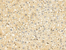 LARS2 Polyclonal Antibody:Antibodies, Polyclonal