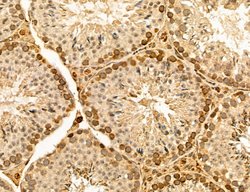 LARS2 Polyclonal Antibody:Antibodies, Polyclonal